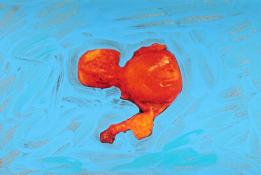 Looks like a goldfish!My uterus out of body.